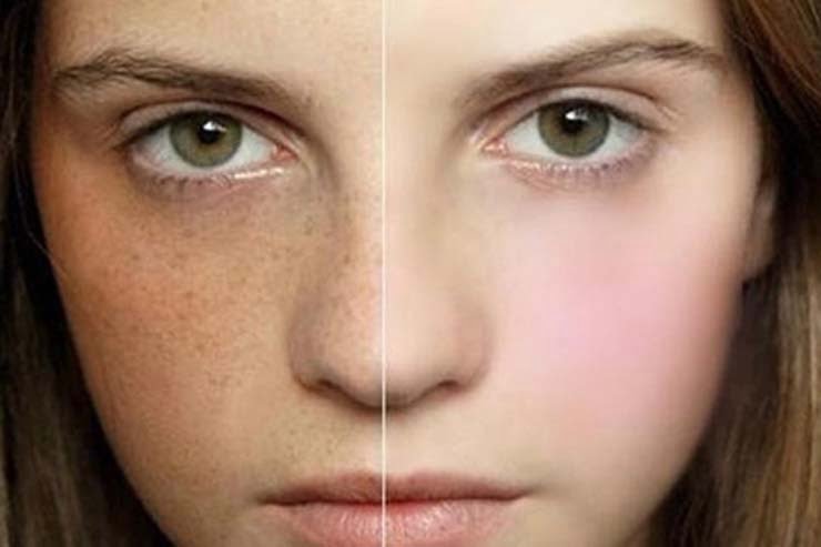 viên trị nám, tàn nhang TRANSINO WHITENING - Nhật